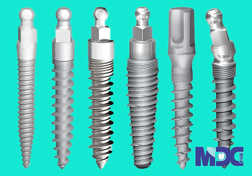 انواع ایمپلنت تیتانیومی-کلینیک دندان پزشکی مدرن