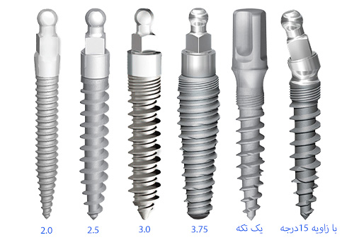 انواع مینی ایمپلنت دندان-کلینیک دندان پزشکی مدرن