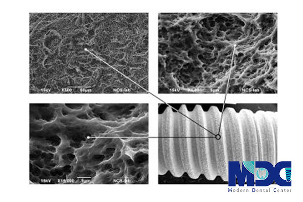 سطح ایمپلنت دندان