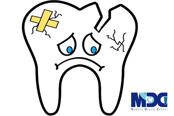 ترمیم دندان شکسته